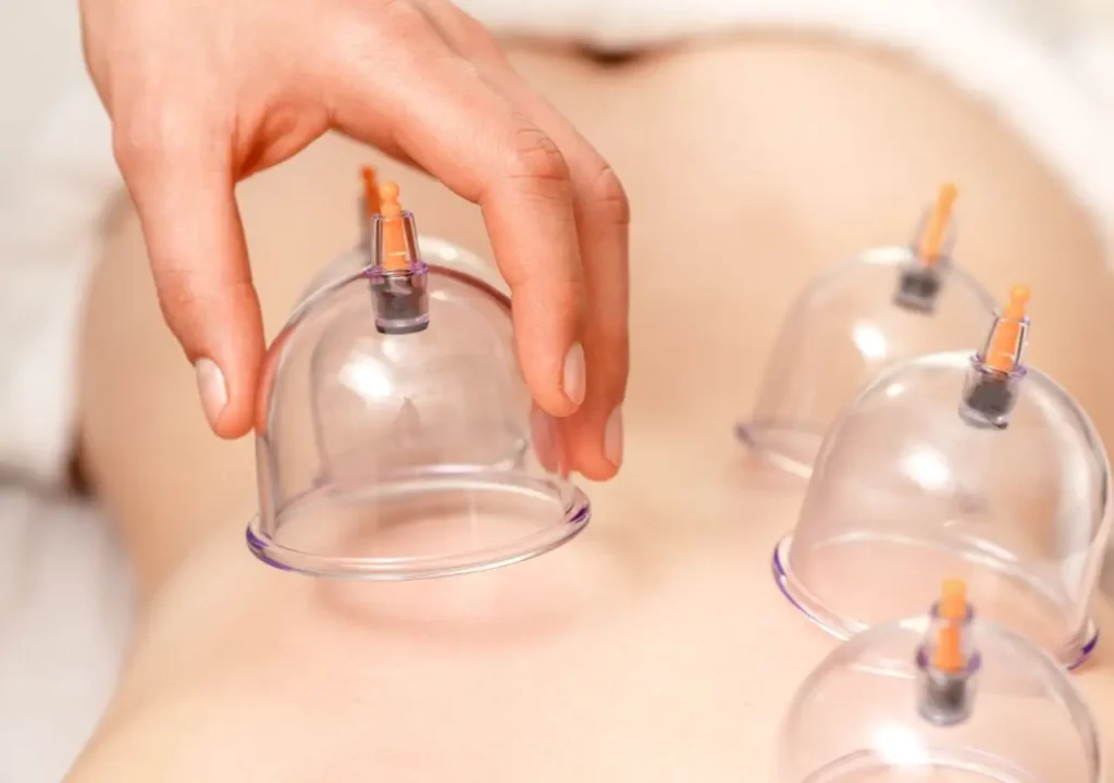 Smart Cupping In Hyderabad